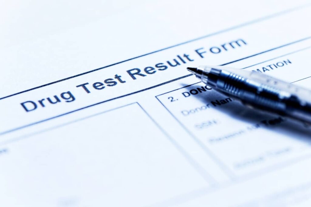 does cbd shows up in drug test
